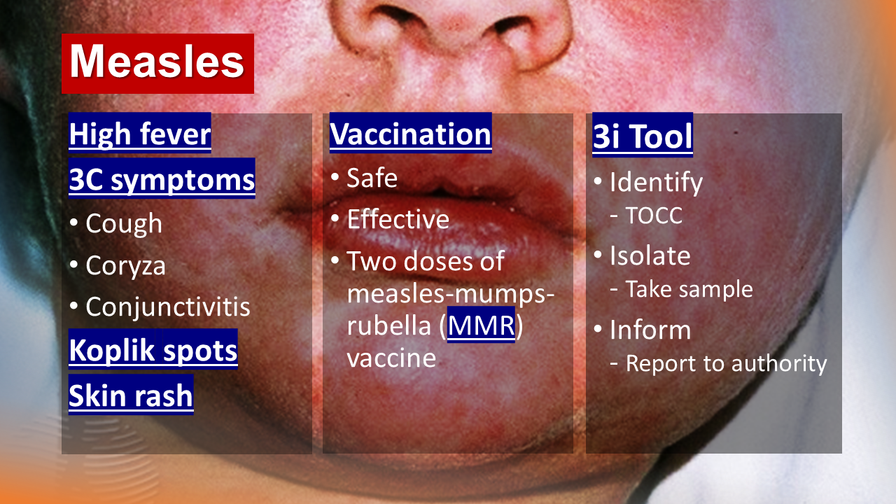 CDC monitoring outbreak of measles | WBIW